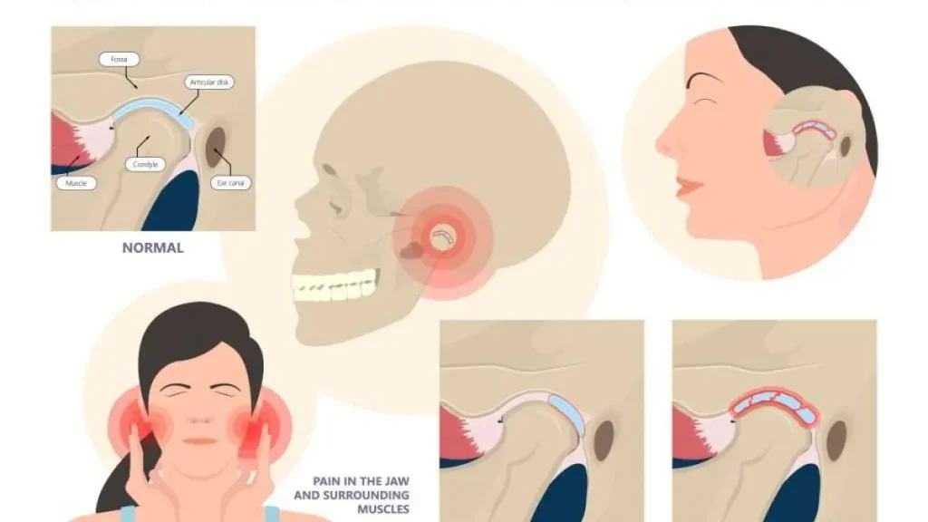 معاینه مفصل فکی گیجگاهی